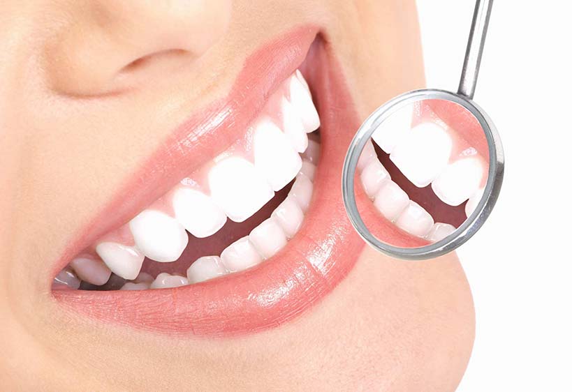 Igiene orale - Centro Odontoiatrico Atena, Brindisi